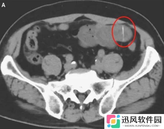 极乐软件园